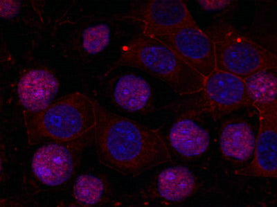 Immunofluorescence staining of methanol-fixed MCF cells using Estrogen Receptor-a(Ab-167) Antibody.Rabbit anti-Human ESR1 Polyclonal Antibody
