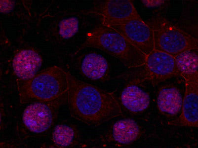 Immunofluorescence staining of methanol-fixed MCF cells using Estrogen Receptor-a(Ab-167) Antibody.Rabbit anti-Human ESR1 Polyclonal Antibody