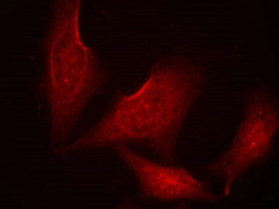 Immunofluorescence staining of methanol-fixed HeLa cells using NF-kappa;B-p65 (phospho-Ser311) antibody.Rabbit anti-Human RELA Polyclonal Antibody