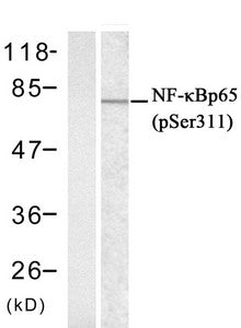 Western blot analysis of extracts from Hela cells untreated or treated with IFN-α  using NFκB-p65((phospho-Ser311) Antibody.Rabbit anti-Human RELA Polyclonal Antibody