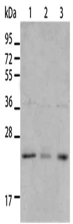 Gel: 12%SDS-PAGE, Lysate: 40 μg, Lane 1-3: A431 cells, A172 cells, human liver cancer tissue, Primary antibody: BNIP1 Antibody(BNIP1 Antibody) at dilution 1/550, Secondary antibody: Goat anti rabbit IgG at 1/8000 dilution, Exposure time: 10 seconds