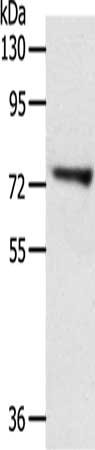 Gel: 8%SDS-PAGE, Lysate: 40 μg, Lane: Lovo cells, Primary antibody: TRIM32 Antibody(TRIM32 Antibody) at dilution 1/200, Secondary antibody: Goat anti rabbit IgG at 1/8000 dilution, Exposure time: 30 minutesRabbit anti-Human TRIM32 Polyclonal Antibody