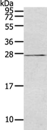 Gel: 12%SDS-PAGE, Lysate: 40 μg, Lane: K562 cell, Primary antibody: SOCS3 Antibody(SOCS3 Antibody) at dilution 1/200 dilution, Secondary antibody: Goat anti rabbit IgG at 1/8000 dilution, Exposure time: 5 secondsRabbit anti-Human SOCS3 Polyclonal Antibody