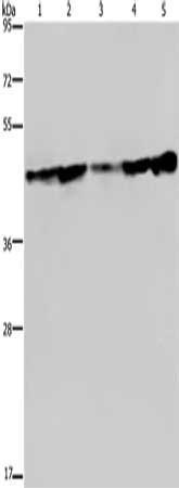 Gel: 8%SDS-PAGE, Lysate: 40 μg, Lane 1-5: Human fetal liver tissue, HT29 cells, HUVEC cells, MCF7 cells, human hepatocellular carcinoma tissue, Primary antibody: CERS4 Antibody(CERS4 Antibody) at dilution 1/300, Secondary antibody: Goat anti rabbit IgG at 1/8000 dilution, Exposure time: 10 secondsRabbit anti-Human CERS4 Polyclonal Antibody