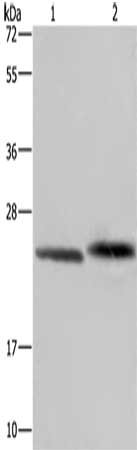 Gel: 10%SDS-PAGE, Lysate: 40 μg, Lane 1-2: Human prostate tissue, Raji cells, Primary antibody: GLO1 Antibody(GLO1 Antibody) at dilution 1/400, Secondary antibody: Goat anti rabbit IgG at 1/8000 dilution, Exposure time: 30 secondsRabbit anti-Human GLO1 Polyclonal Antibody