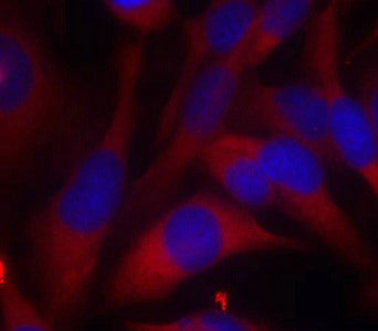 Immunofluorescence staining of methanol-fixed Hela cells using MKK6(Ab-207) Antibody.Rabbit anti-Human MAP2K6 Polyclonal Antibody