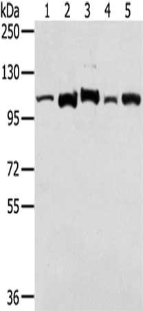 Gel: 6%SDS-PAGE,Lysate: 40 μg,Lane 1-5: A431 cells, NIH/3T3 cells, HepG2 cells, Mouse liver tissue, Hela cells,Primary antibody: LONP1 Antibody(LONP1 Antibody) at dilution 1/250 dilution,Secondary antibody: Goat anti rabbit IgG at 1/8000 dilution,Exposure time: 30 secondsRabbit anti-Human LONP1 Polyclonal Antibody