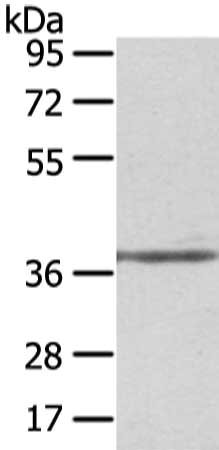 Gel: 8%SDS-PAGE, Lysate: 40 μg, Lane: Mouse brain tissue, Primary antibody: STRAP Antibody(STRAP Antibody) at dilution 1/400 dilution, Secondary antibody: Goat anti rabbit IgG at 1/8000 dilution, Exposure time: 10 secondsRabbit anti-Human STRAP Polyclonal Antibody