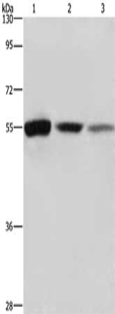 Gel: 8%SDS-PAGE, Lysate: 40 μg, Lane 1-3: Mouse liver, Mouse kidney tissue, Mouse pancreas tissue, Primary antibody: BLNK Antibody(BLNK Antibody) at dilution 1/550, Secondary antibody: Goat anti rabbit IgG at 1/8000 dilution, Exposure time: 40 seconds