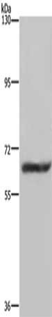 Gel: 6%SDS-PAGE, Lysate: 40 μg, Lane: Human fetal brain tissue, Primary antibody: FTO Antibody(FTO Antibody) at dilution 1/650, Secondary antibody: Goat anti rabbit IgG at 1/8000 dilution, Exposure time: 5 minutesRabbit anti-Human FTO Polyclonal Antibody