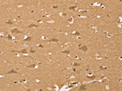 The image on the left is immunohistochemistry of paraffin-embedded Human brain  tissue using HIF1AN Antibody(HIF1AN Antibody) at dilution 1/40, on the right is treated with synthetic peptide. (Original magnification: ×200)Rabbit anti-Human HIF1AN Polyclonal Antibody