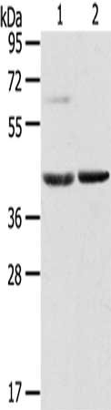Gel: 8%SDS-PAGE, Lysate: 60 μg, Lane 1-2: Mouse brain tissue, Mouse liver tissue, Primary antibody: HIF1AN Antibody(HIF1AN Antibody) at dilution 1/200, Secondary antibody: Goat anti rabbit IgG at 1/8000 dilution, Exposure time: 20 secondsRabbit anti-Human HIF1AN Polyclonal Antibody