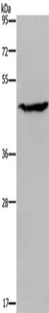 Gel: 8%SDS-PAGE, Lysate: 40 μg, Lane: K562 cells, Primary antibody: ACP6 Antibody(ACP6 Antibody) at dilution 1/200, Secondary antibody: Goat anti rabbit IgG at 1/8000 dilution, Exposure time: 5 secondsRabbit anti-Human ACP6 Polyclonal Antibody