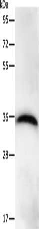Gel: 10%SDS-PAGE, Lysate: 40 μg, Lane: Hela cells, Primary antibody: PPP1CB Antibody(PPP1CB Antibody) at dilution 1/450, Secondary antibody: Goat anti rabbit IgG at 1/8000 dilution, Exposure time: 20 secondsRabbit anti-Human PPP1CB Polyclonal Antibody