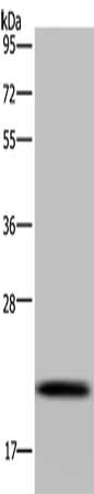Gel: 10%SDS-PAGE, Lysate: 40 μg, Lane: Raji cells, Primary antibody: NDUFAF4 Antibody(NDUFAF4 Antibody) at dilution 1/300, Secondary antibody: Goat anti rabbit IgG at 1/8000 dilution, Exposure time: 5 secondsRabbit anti-Human NDUFAF4 Polyclonal Antibody