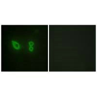 Immunofluorescence analysis of HeLa cells, using Actin α-2/3 antibody.