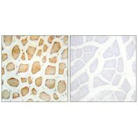 Immunohistochemistry analysis of paraffin-embedded human skeletal muscle tissue using Actin α-2/3 antibody.