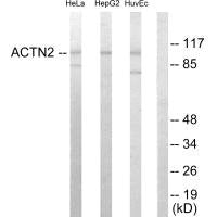 Western blot analysis of extracts from HeLa cells, HepG2 cells and HUVEC cells, using Actin α-2/3 antibody.