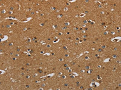 The image on the left is immunohistochemistry of paraffin-embedded Human brain  tissue using HSD17B2 Antibody(HSD17B2 Antibody) at dilution 1/50, on the right is treated with fusion protein. (Original magnification: ×200)Rabbit anti-Human HSD17B2 Polyclonal Antibody