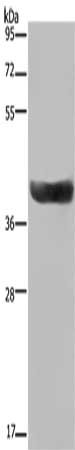 Gel: 8%SDS-PAGE, Lysate: 40 μg, Lane: Human fetal liver tissue, Primary antibody: HSD17B2 Antibody(HSD17B2 Antibody) at dilution 1/300, Secondary antibody: Goat anti rabbit IgG at 1/8000 dilution, Exposure time: 1 minuteRabbit anti-Human HSD17B2 Polyclonal Antibody