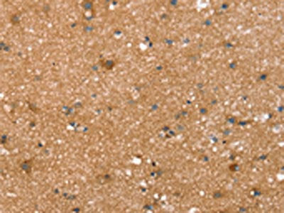 The image on the left is immunohistochemistry of paraffin-embedded Human brain tissue using the antibody Antibody) at dilution 1/20, on the right is treated with synthetic peptide. (Original magnification: ×200)Rabbit anti-Human SPATA5L1 Polyclonal Antibody