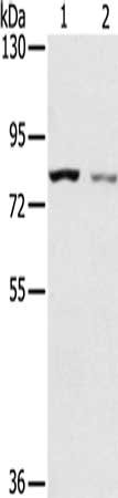 Gel: 6%SDS-PAGE, Lysate: 40 μg, Lane 1-2: A549 cells, A172 cells, Primary antibody: SPATA5L1 Antibody(SPATA5L1 Antibody) at dilution 1/200, Secondary antibody: Goat anti rabbit IgG at 1/8000 dilution, Exposure time: 2 minutesRabbit anti-Human SPATA5L1 Polyclonal Antibody