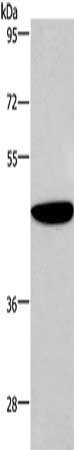 Gel: 8%SDS-PAGE, Lysate: 40 μg, Lane: Human fetal brain tissue, Primary antibody: ABI1 Antibody(ABI1 Antibody) at dilution 1/300, Secondary antibody: Goat anti rabbit IgG at 1/8000 dilution, Exposure time: 20 seconds