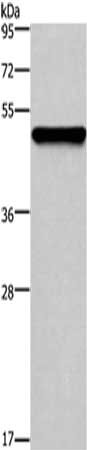 Gel: 8%SDS-PAGE,Lysate: 20 μg,,Primary antibody: KRT14 Antibody(KRT14 Antibody) at dilution 1/1000 dilution,Secondary antibody: Goat anti rabbit IgG at 1/8000 dilution,Exposure time: 20 seconds