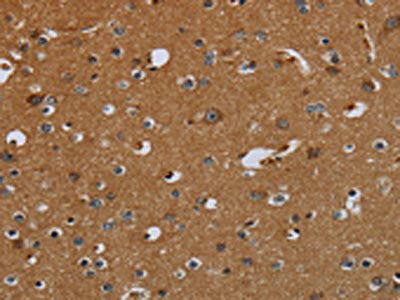 The image on the left is immunohistochemistry of paraffin-embedded Human brain tissue using the antibody Antibody) at dilution 1/60, on the right is treated with fusion protein. (Original magnification: ×200)Rabbit anti-Human PCK2 Polyclonal Antibody
