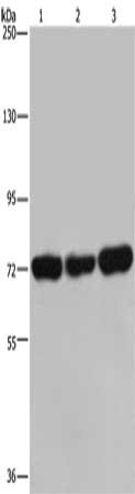 Gel: 6%SDS-PAGE, Lysate: 40 μg, Lane 1-3: 293T cells, Jurkat cells, Hela cells, Primary antibody: PCK2 Antibody(PCK2 Antibody) at dilution 1/600, Secondary antibody: Goat anti rabbit IgG at 1/8000 dilution, Exposure time: 10 minutesRabbit anti-Human PCK2 Polyclonal Antibody