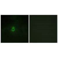 Immunofluorescence analysis of HepG2 cells, using Cytochrome P450 2E1 antibody.Rabbit anti-Human CYP2E1 Polyclonal Antibody