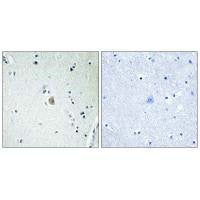 Immunohistochemistry analysis of paraffin-embedded human brain tissue, using Cytochrome P450 2E1 antibody.Rabbit anti-Human CYP2E1 Polyclonal Antibody