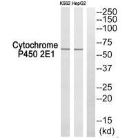 Western blot analysis of extracts from K562 cells and HepG2 cells, using Cytochrome P450 2E1 antibody.Rabbit anti-Human CYP2E1 Polyclonal Antibody