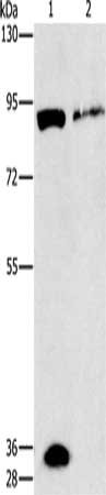 Gel: 8%SDS-PAGE, Lysate: 50 μg, Lane 1-2: Mouse brain tissue, Mouse lung tissue, Primary antibody: PRKG2 Antibody(PRKG2 Antibody) at dilution 1/160, Secondary antibody: Goat anti rabbit IgG at 1/8000 dilution, Exposure time: 30 secondsRabbit anti-Human PRKG2 Polyclonal Antibody