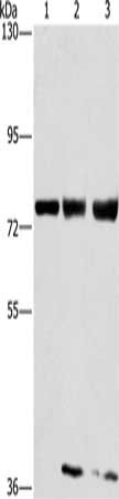Gel: 6%SDS-PAGE, Lysate: 40 μg, Lane 1-3: MCF7 cells, hela cells, 293T cells, Primary antibody: GGCX Antibody(GGCX Antibody) at dilution 1/400, Secondary antibody: Goat anti rabbit IgG at 1/8000 dilution, Exposure time: 40 secondsRabbit anti-Human GGCX Polyclonal Antibody