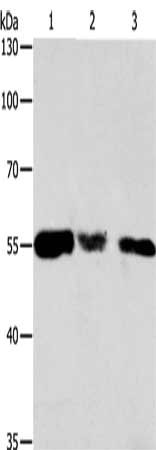 Gel: 10%SDS-PAGE, Lysate: 40 μg, Lane 1-3: Hela cells, 293T cells, NIH/3T3 cells, Primary antibody: CALR Antibody(CALR Antibody) at dilution 1/500, Secondary antibody: Goat anti rabbit IgG at 1/8000 dilution, Exposure time: 30 seconds