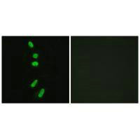 Immunofluorescence analysis of HeLa cells, using SF1 (Ab-82) antibody.Rabbit anti-Human SF1 Polyclonal Antibody