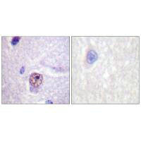 Immunohistochemistry analysis of paraffin-embedded human brain tissue using SF1 (Ab-82) antibody.Rabbit anti-Human SF1 Polyclonal Antibody