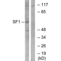Western blot analysis of extracts from COLO205 cells, using SF1 (Ab-82) antibody.Rabbit anti-Human SF1 Polyclonal Antibody