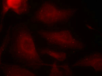 Immunofluorescence staining of methanol-fixed Hela cells using Tau(Phospho-Ser404) Antibody.