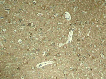 Immunohistochemical analysis of paraffin-embedded rat hippocampal region tissue from a model with Alzheimer