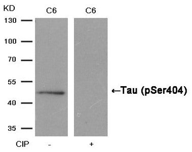 Western blot analysis of extracts from C6 cells, treated with calf intestinal phosphatase (CIP), using Tau (Phospho-Ser404) Antibody.