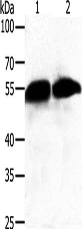 Gel: 10%SDS-PAGE, Lysate: 50 μg, Lane 1-2: Human fetal liver tissue, A549 cells, Primary antibody: GC Antibody(GC Antibody) at dilution 1/500, Secondary antibody: Goat anti rabbit IgG at 1/8000 dilution, Exposure time: 20 secondsRabbit anti-Human GC Polyclonal Antibody