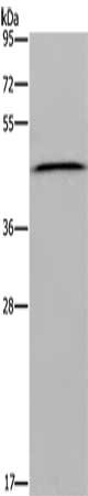 Gel: 8%SDS-PAGE, Lysate: 40 μg, Lane: Human placenta tissue, Primary antibody: EPSTI1 Antibody(EPSTI1 Antibody) at dilution 1/1900, Secondary antibody: Goat anti rabbit IgG at 1/8000 dilution, Exposure time: 30 secondsRabbit anti-Human EPSTI1 Polyclonal Antibody