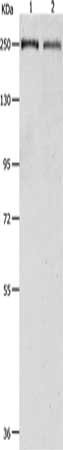 Gel: 8%SDS-PAGE, Lysate: 40 μg, Lane 1-2: K562 cells, 231 cells, Primary antibody: ACIN1 Antibody(ACIN1 Antibody) at dilution 1/500, Secondary antibody: Goat anti rabbit IgG at 1/8000 dilution, Exposure time: 10 seconds
