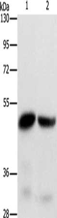 Gel: 8%SDS-PAGE, Lysate: 40 μg, Lane 1-2: Mouse intestinum tenue tissue, Mouse liver tissue, Primary antibody: IDH1 Antibody(IDH1 Antibody) at dilution 1/275, Secondary antibody: Goat anti rabbit IgG at 1/8000 dilution, Exposure time: 1 secondRabbit anti-Human IDH1 Polyclonal Antibody