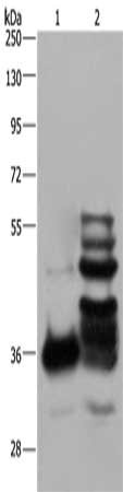 Gel: 8%SDS-PAGE, Lysate: 40 μg, Lane 1-2: Human fetal brain tissue, mouse brain tissue, Primary antibody: GAS7 Antibody(GAS7 Antibody) at dilution 1/600, Secondary antibody: Goat anti rabbit IgG at 1/8000 dilution, Exposure time: 40 secondsRabbit anti-Human GAS7 Polyclonal Antibody