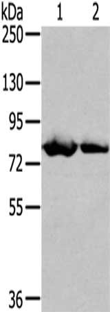 Gel: 6%SDS-PAGE,Lysate: 40 μg,Lane 1-2: Mouse heart tissue, MCF7 cells,Primary antibody: TGM5 Antibody(TGM5 Antibody) at dilution 1/400 dilution,Secondary antibody: Goat anti rabbit IgG at 1/8000 dilution,Exposure time: 2 minutes