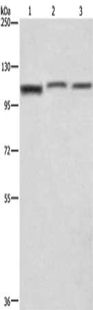 Gel: 10%SDS-PAGE, Lysate: 40 μg, Lane 1-3: PC3 cells, human brain malignant glioma tissue, A172 cells, Primary antibody: CTAGE5 Antibody(CTAGE5 Antibody) at dilution 1/200, Secondary antibody: Goat anti rabbit IgG at 1/8000 dilution, Exposure time: 1 secondRabbit anti-Human CTAGE5 Polyclonal Antibody