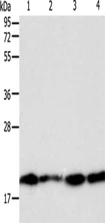 Gel: 12%SDS-PAGE, Lysate: 40 μg, Lane 1-4: Lncap cells, SKOV3 cells, MCF7 cells, 293T cells, Primary antibody: DIABLO Antibody(DIABLO Antibody) at dilution 1/800, Secondary antibody: Goat anti rabbit IgG at 1/8000 dilution, Exposure time: 1 secondRabbit anti-Human DIABLO Polyclonal Antibody
